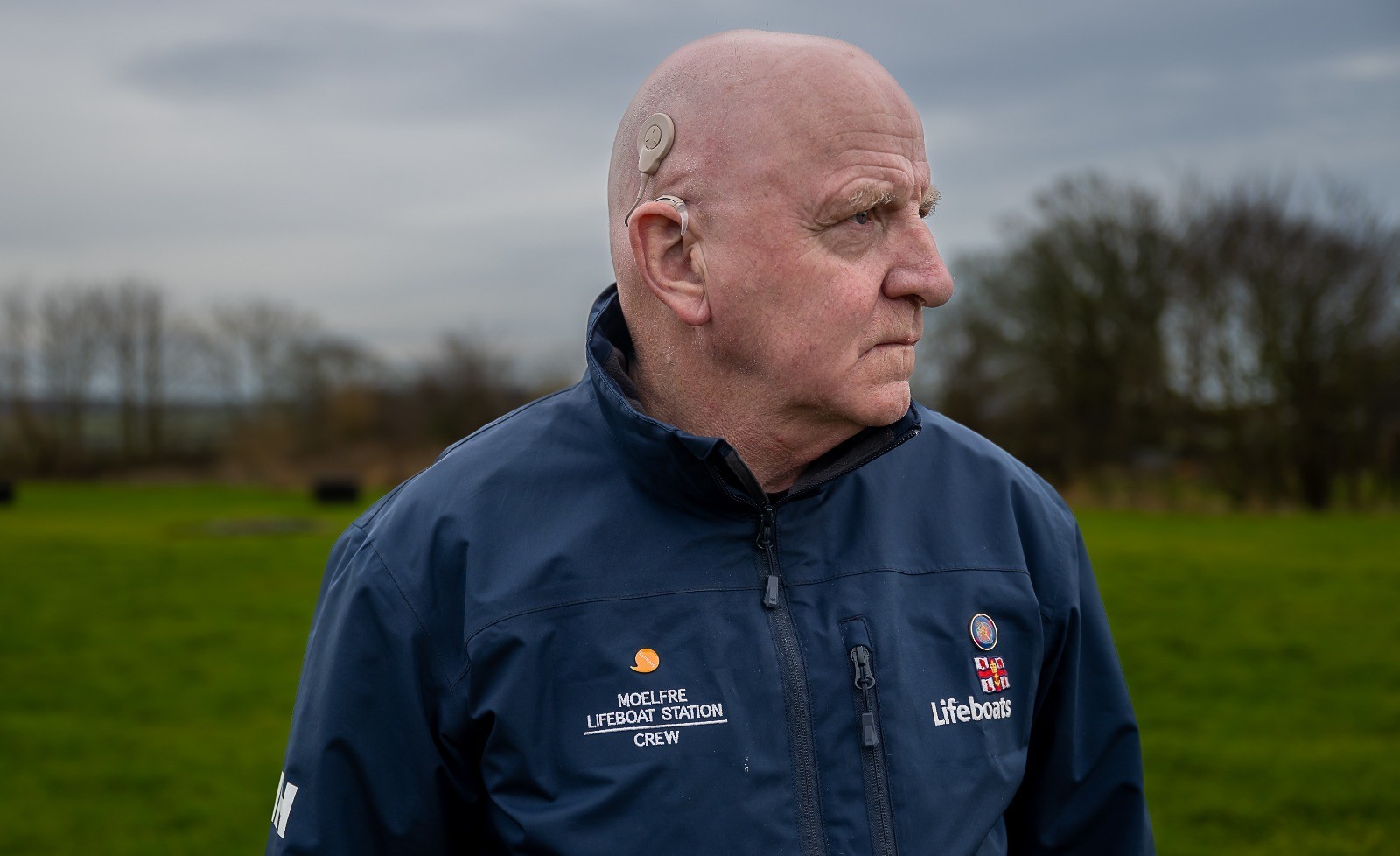 RNLI Moelfre volunteer Phil Williams showing his cochlear implant